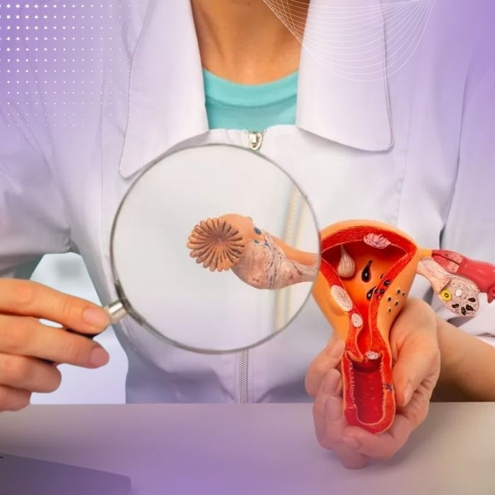 Diagnóstico y Cirugía de Cáncer de Ovario en Panamá